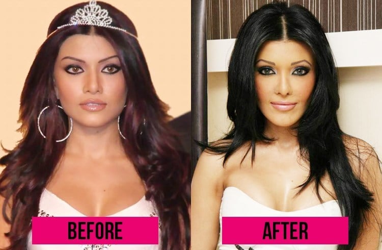 11 Bollywood Plastic Surgeries That Horribly Went Wrong