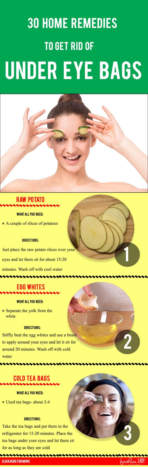 30 Home Remedies To Get Rid Of Under Eye Bags