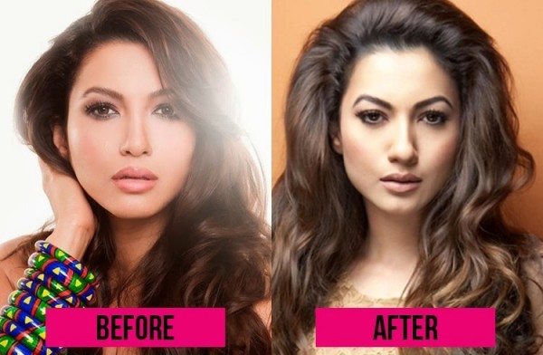 12 Bollywood Plastic Surgeries That Horribly Went Wrong