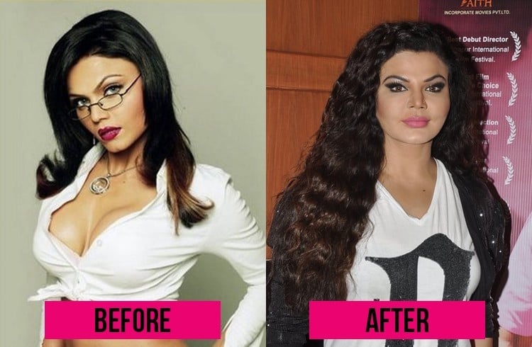 12 Bollywood Plastic Surgeries That Horribly Went Wrong
