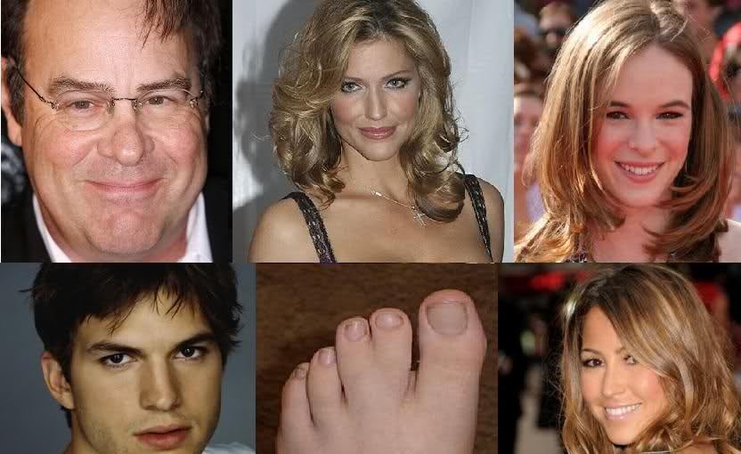 Celebrities With Deformities These Have Hardly Altered Their Status