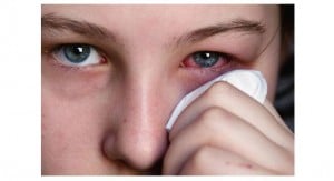 How To Treat Eye Infection At Home With Simple Home Remedies