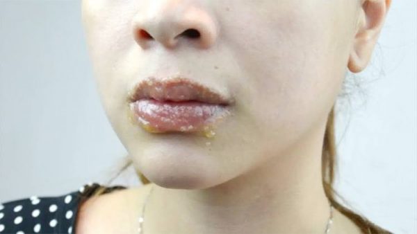 Here Are 5 Makeup Hacks That Help You Get Fuller Lips Within Minutes 6241