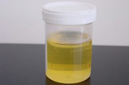 Foamy Urine - Causes And Remedies