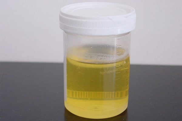 foamy-urine-causes-and-remedies