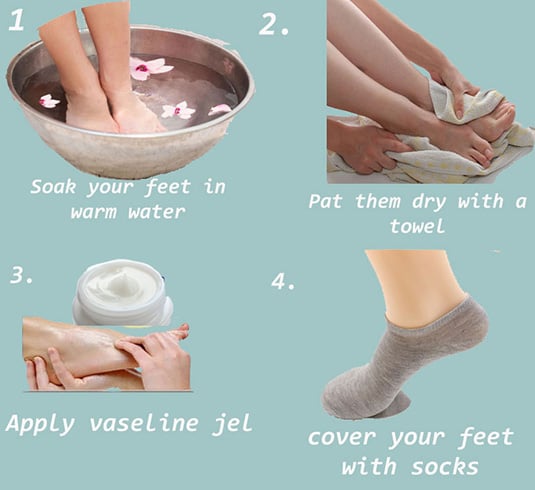 Home Remedies For Treating Dry Cracked Feet
