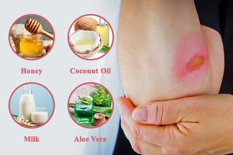 home remedy for chemical burn on face