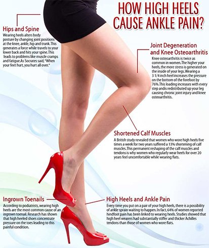 Side Effects Of High Heels 