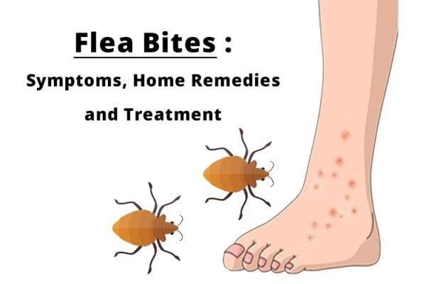 long long do flea bites itch