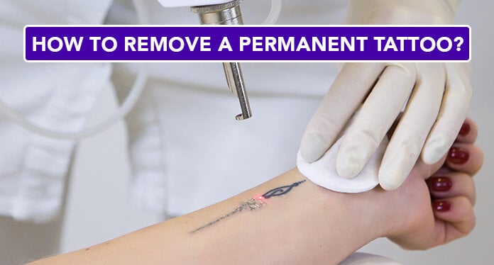 PSA AtHome Tattoo Removal Is Dangerous and Ineffective